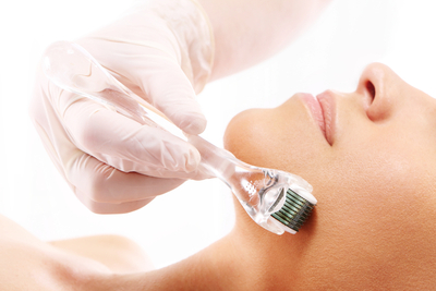 Microagulhamento 4 sessões