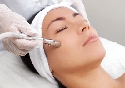 Peeling Diamante 4 sessões